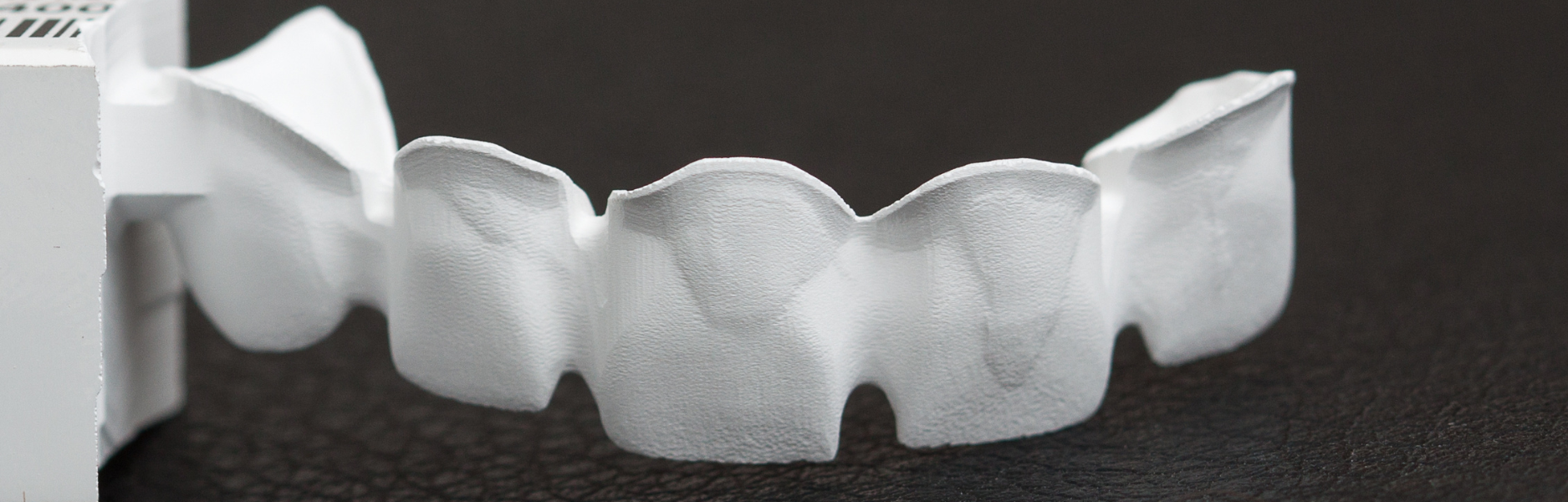Zirconia Vs PFM : A Never Ending Tug of War!